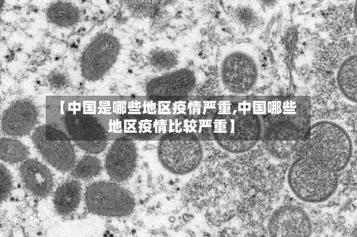 【中国是哪些地区疫情严重,中国哪些地区疫情比较严重】