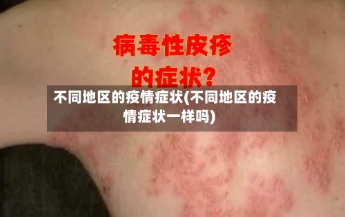 不同地区的疫情症状(不同地区的疫情症状一样吗)